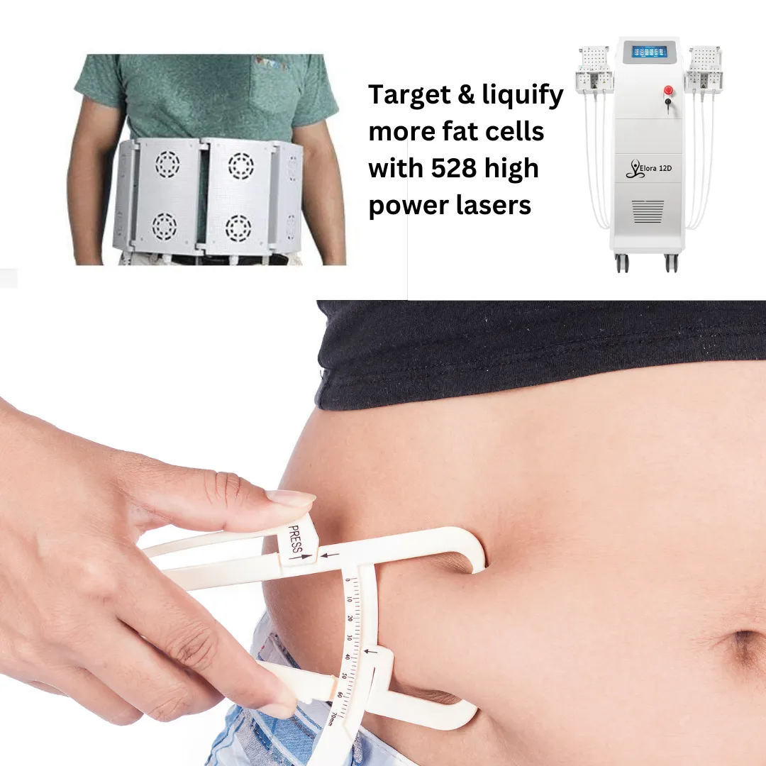 Elora 12D Diode Lipo Laser Weight Loss Machine